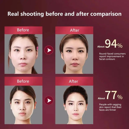 Facial Lifting Massager 12 Gears Electric Facial Massager V-Line Face Lifting Slimming Vibration Device Home Use Beauty Tool